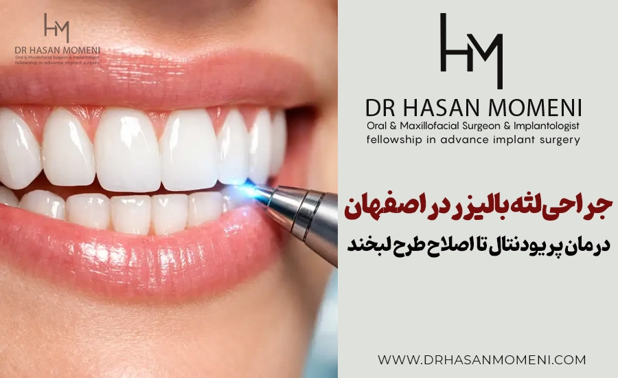 جراحی لثه با لیزر در اصفهان (بدون درد) | دکتر حسن مومنی