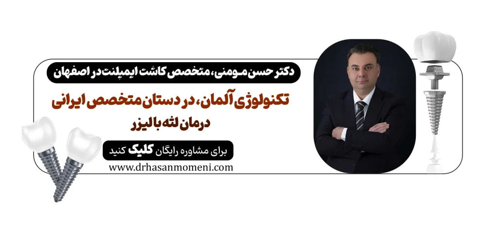 جراحی لثه با لیزر در اصفهان (بدون درد) دکتر حسن مومنی رزرو نوبت فوری