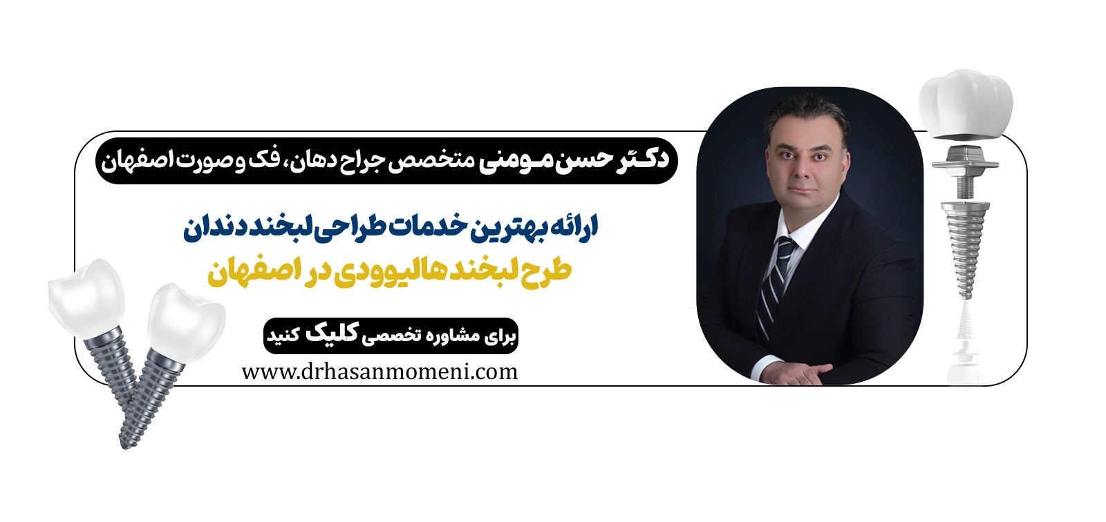 کلینیک دکتر مومنی بهترین انتخاب برای طراحی لبخند در اصفهان- نوبت دهی برای طراحی لبخند در اصفهان
