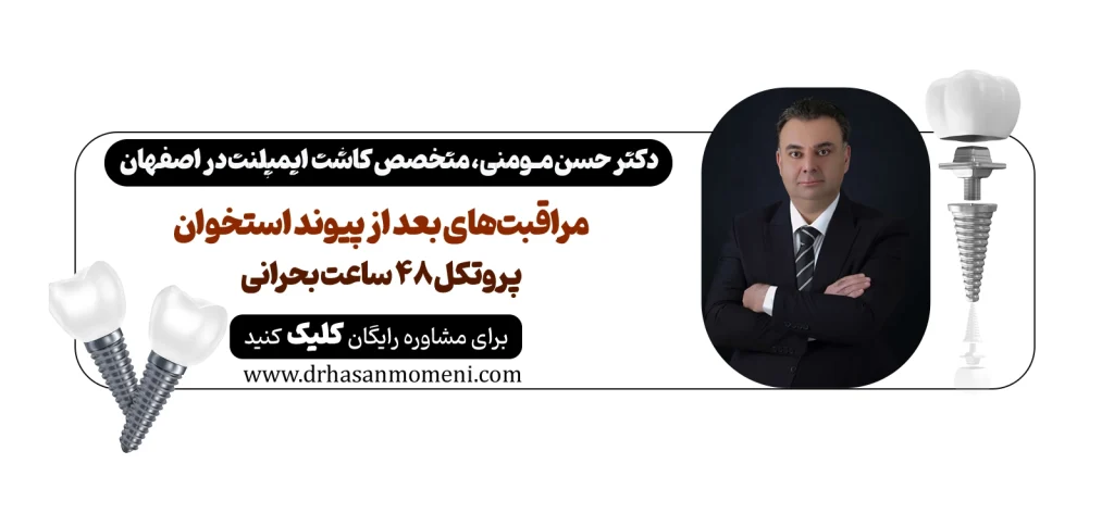 مراقبت‌های بعد از پیوند استخوان فک مشاوره آنلاین با دکتر حسن مومنی متخصص پیوند استخوان فک در اصفهان