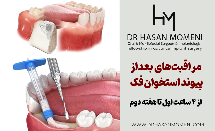 مراقبت های بعد از پیوند استخوان دندان