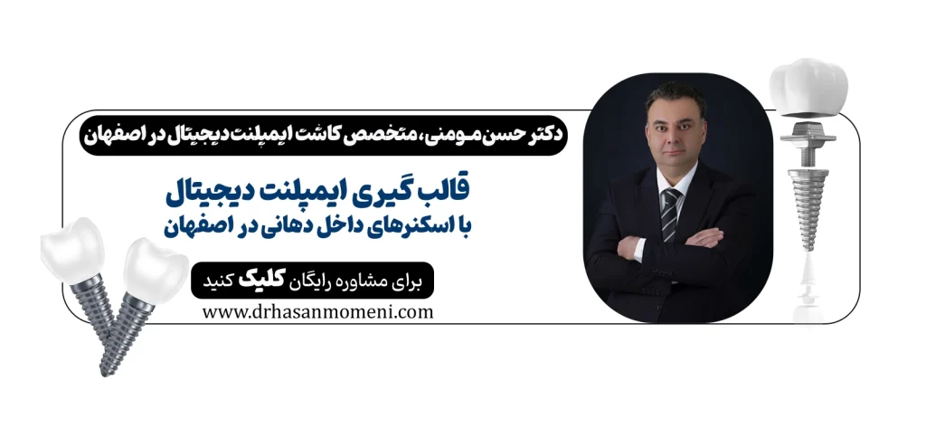 قالب‌ گیری دیجیتال ایمپلنت با اسکنرهای داخل دهانی دیجیتالی در اصفهان کلینیک دکتر حسن مومنی