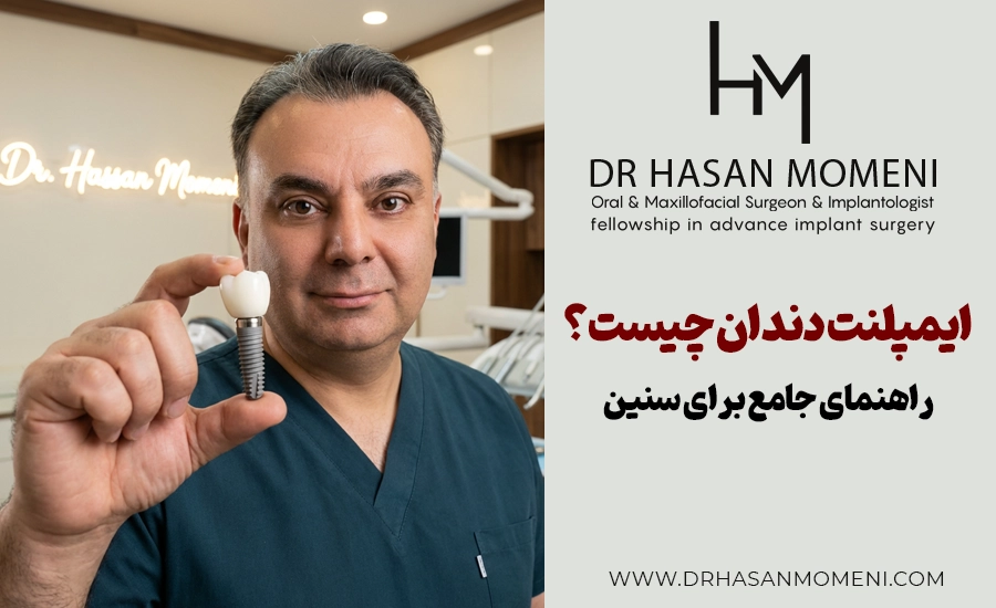 ایمپلنت دندان چیست؟ (راهنمای جامع برای همه)