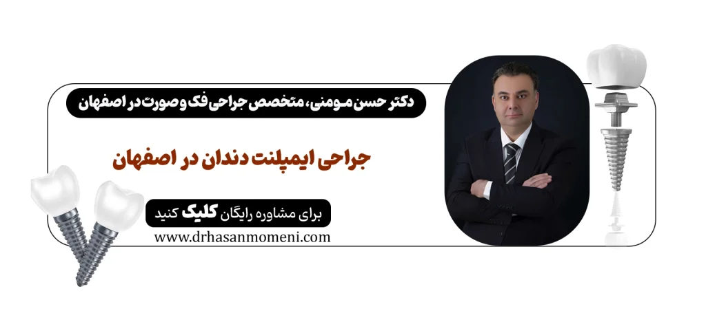 مشاوره انلاین برای کاشت ایمپلنت در اصفهان