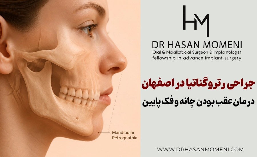 جراحی رتروگناتیا در اصفهان درمان عقب بودن چانه و فک پایین